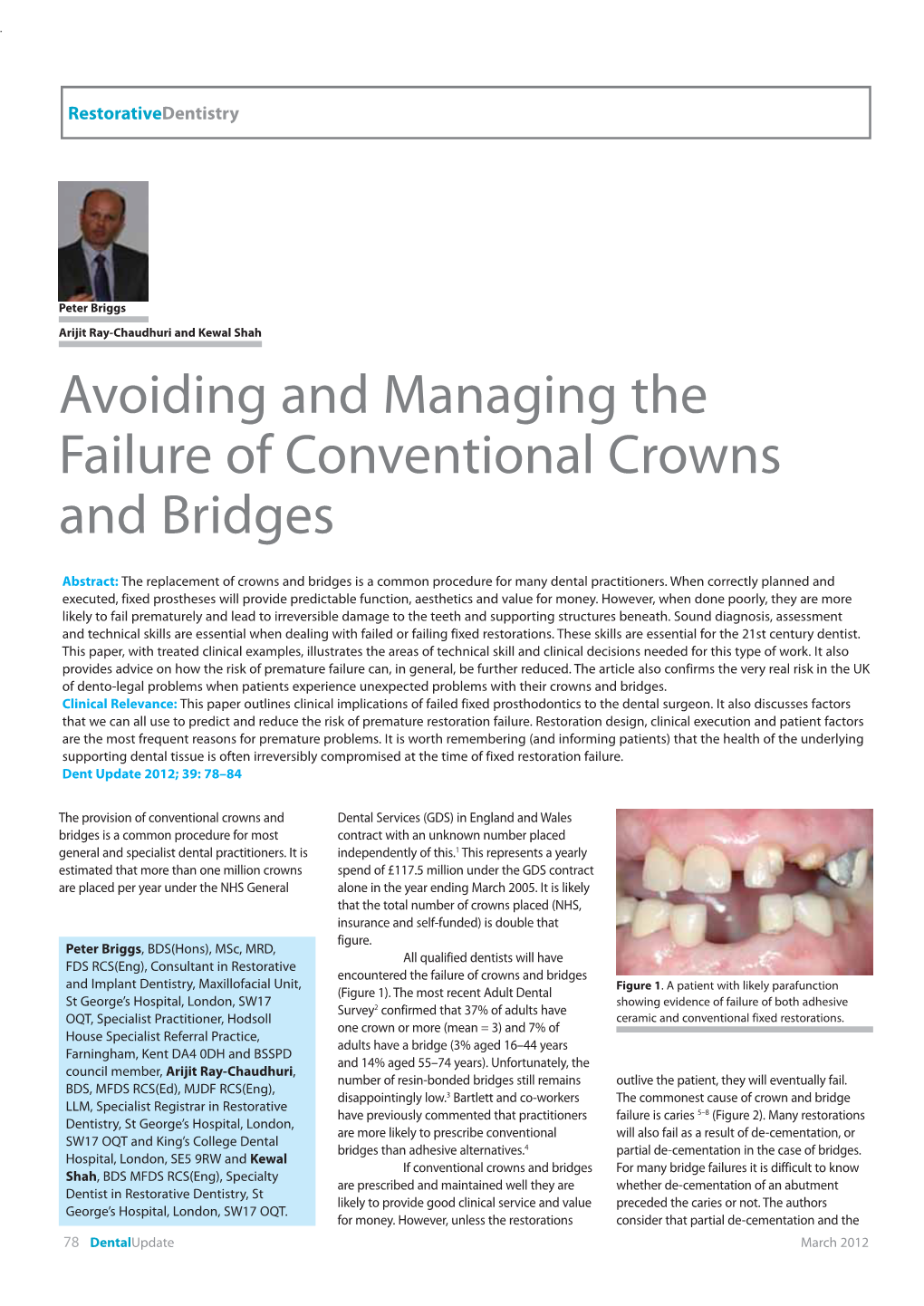 Avoiding and Managing the Failure of Conventional Crowns and Bridges