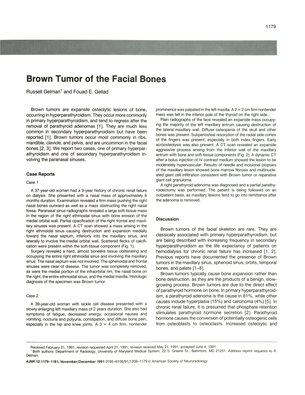 Brown Tumor of the Facial Bones