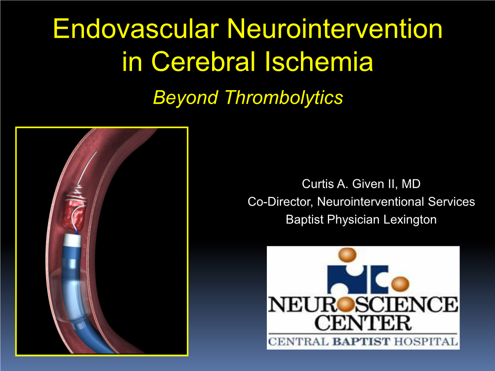 Endovascular Neurointervention in Cerebral Ischemia Beyond Thrombolytics