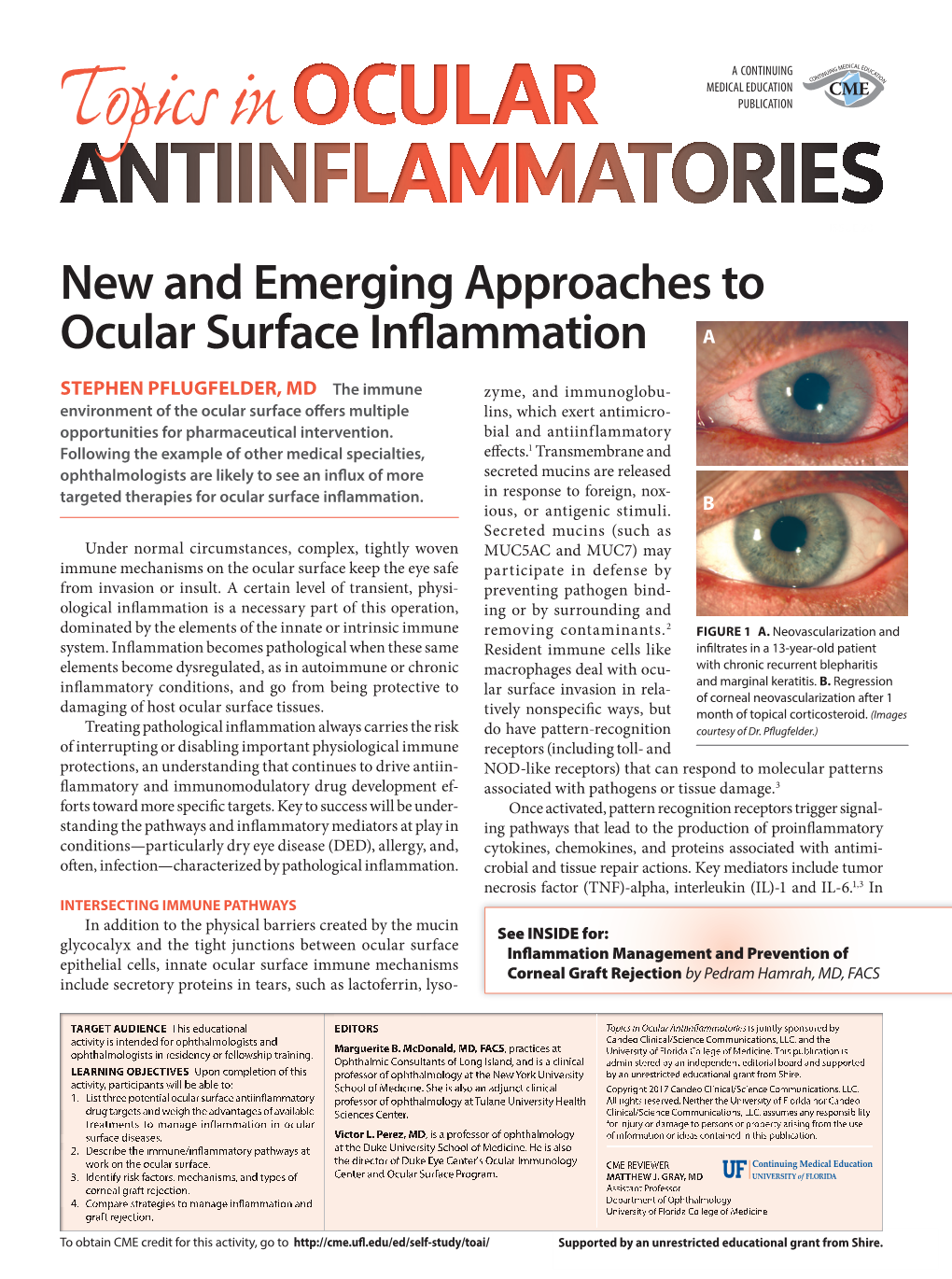 New and Emerging Approaches to Ocular Surface Inflammation