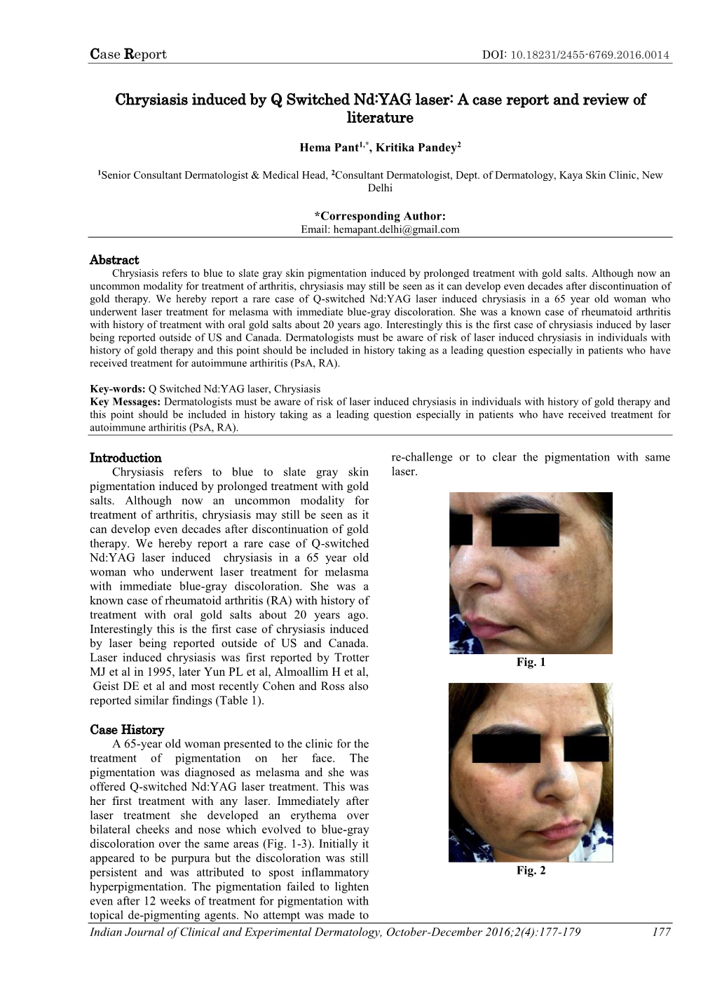 Chrysiasis Induced by Q Switched Nd:YAG Laser: a Case Report and Review of Literature