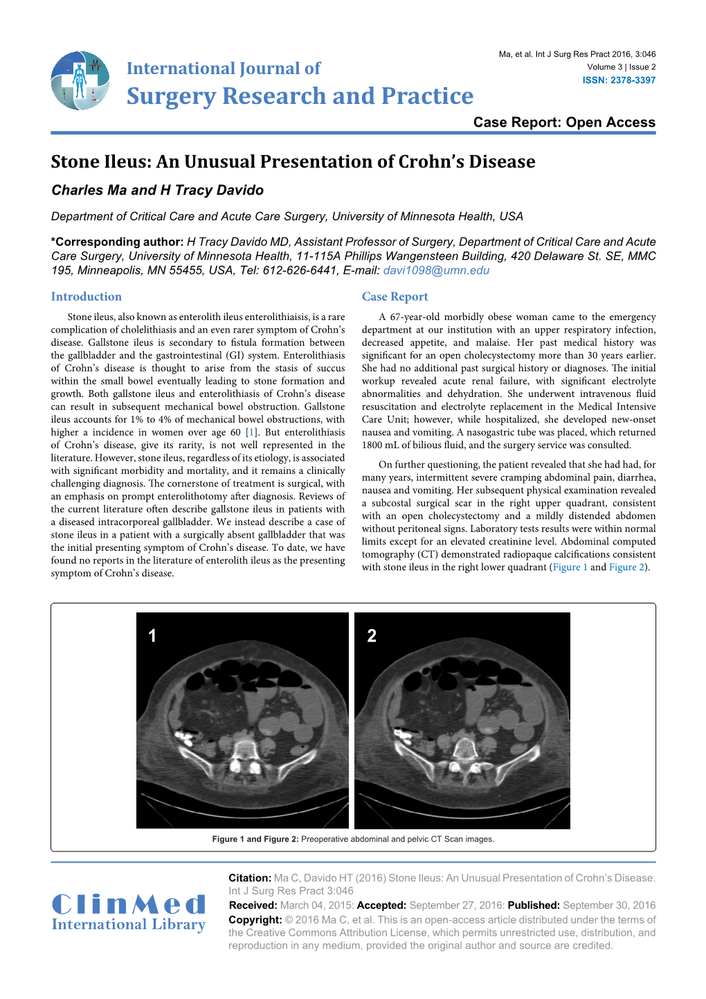 Stone Ileus: an Unusual Presentation of Crohn's Disease