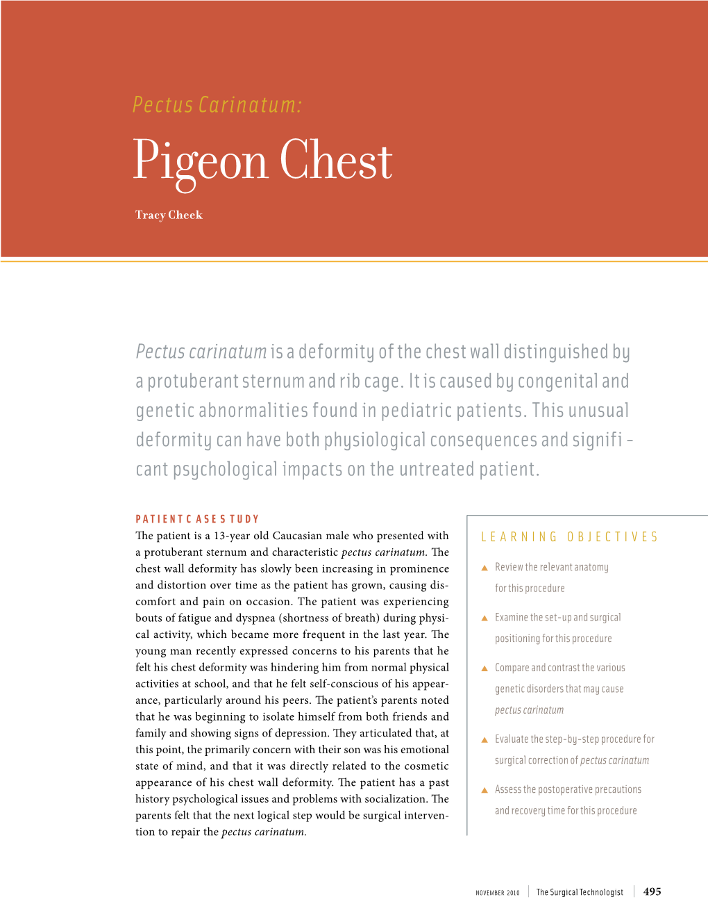 323: Pectus Carinatum: Pigeon Chest