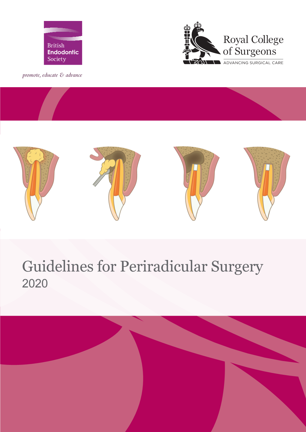 Guidelines for Periradicular Surgery 2020