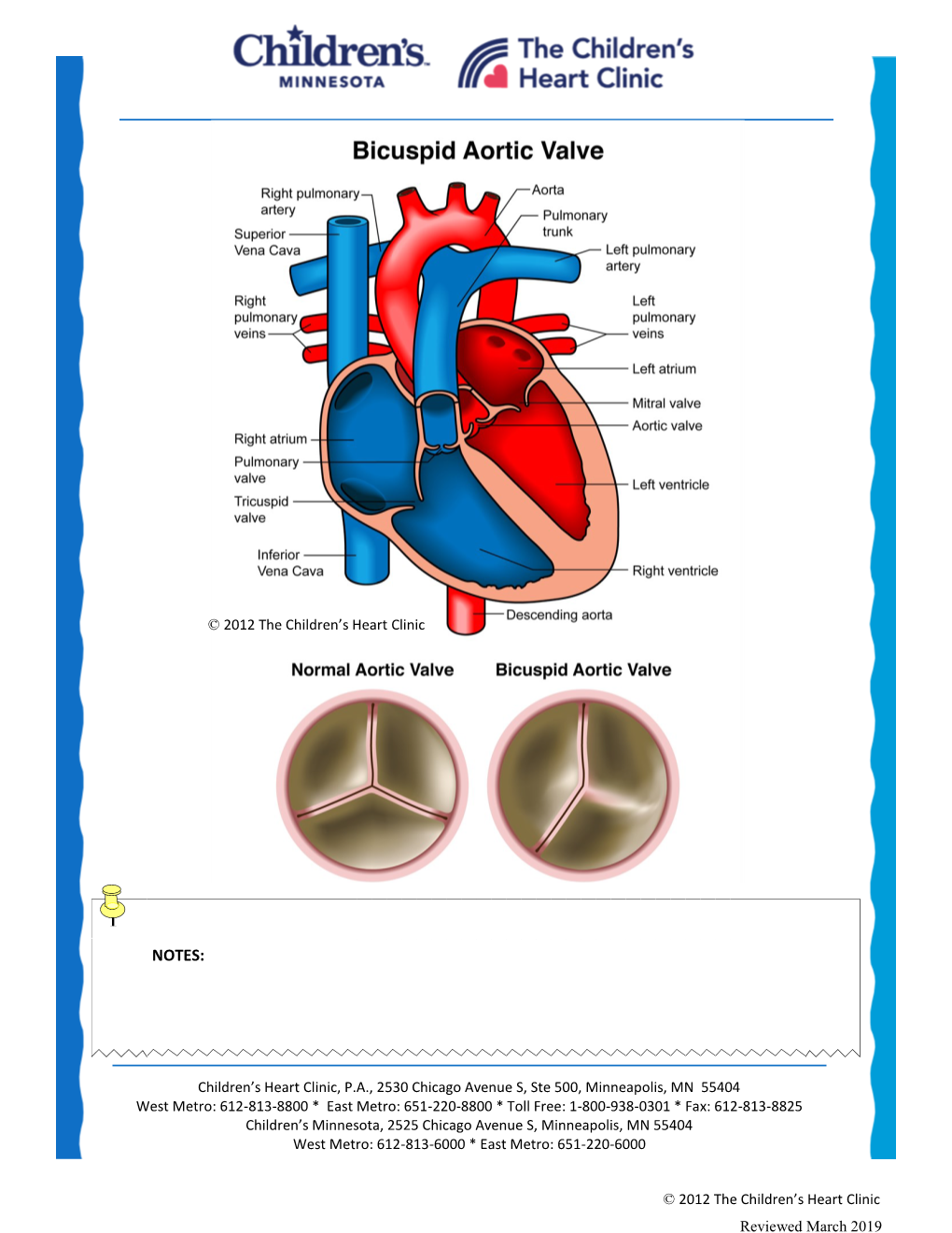 Bicuspid Aortic Valve