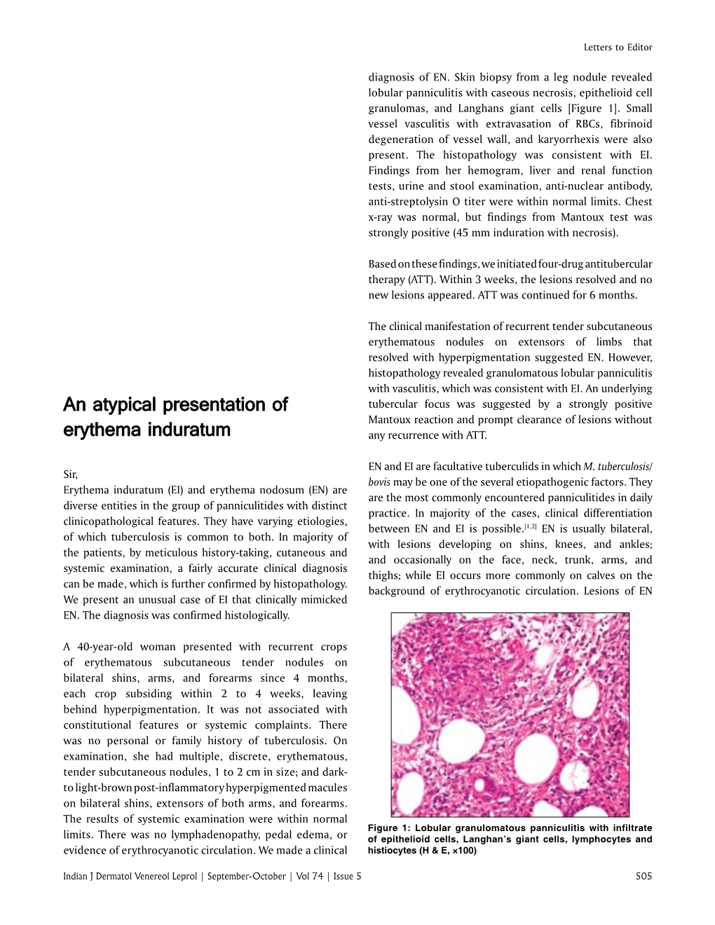 An Atypical Presentation of Erythema Induratum