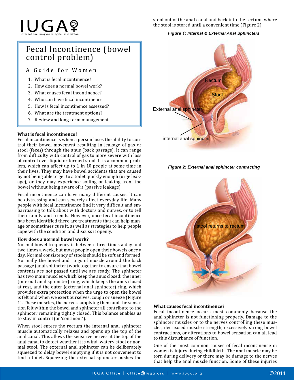 Fecal Incontinence (Bowel Control Problem) a Guide for Women