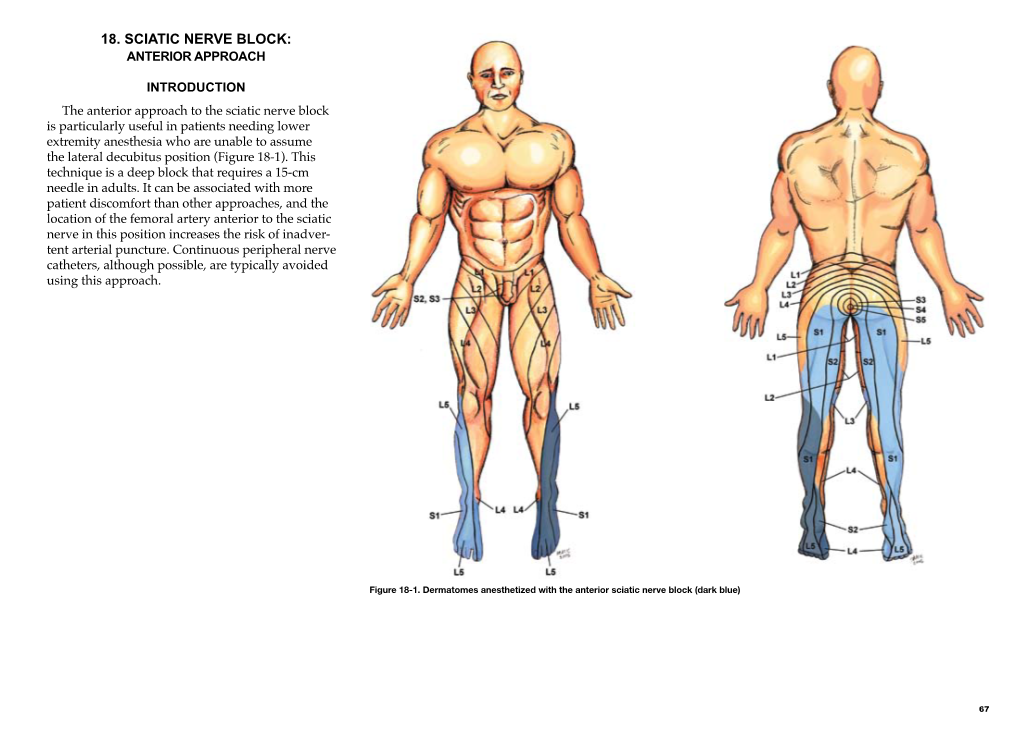 Chapter 18 – Sciatic Nerve Block: Anterior Approach