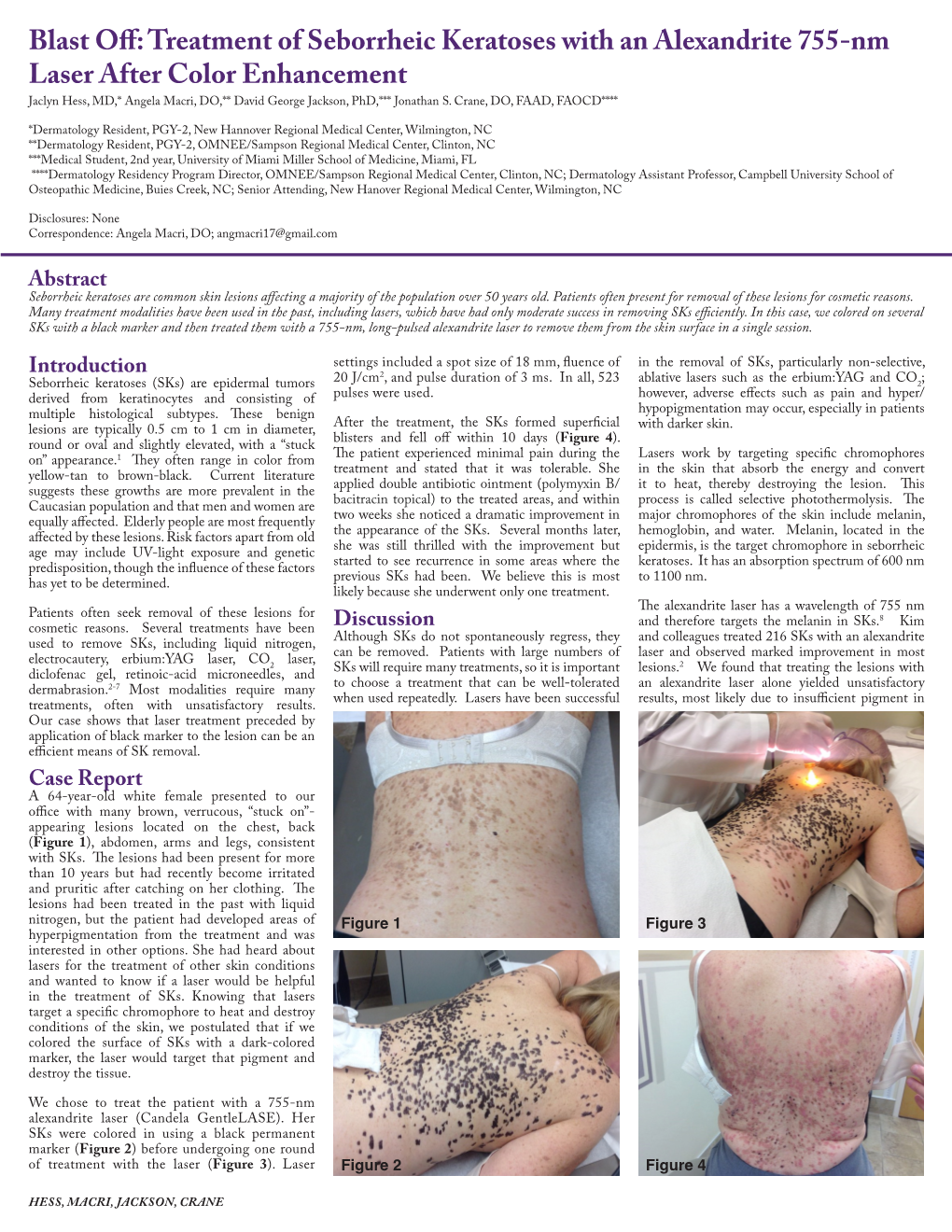 Treatment of Seborrheic Keratoses with an Alexandrite 755-Nm Laser