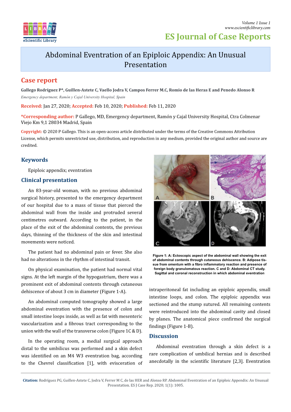 Abdominal Eventration of an Epiploic Appendix: an Unusual Presentation