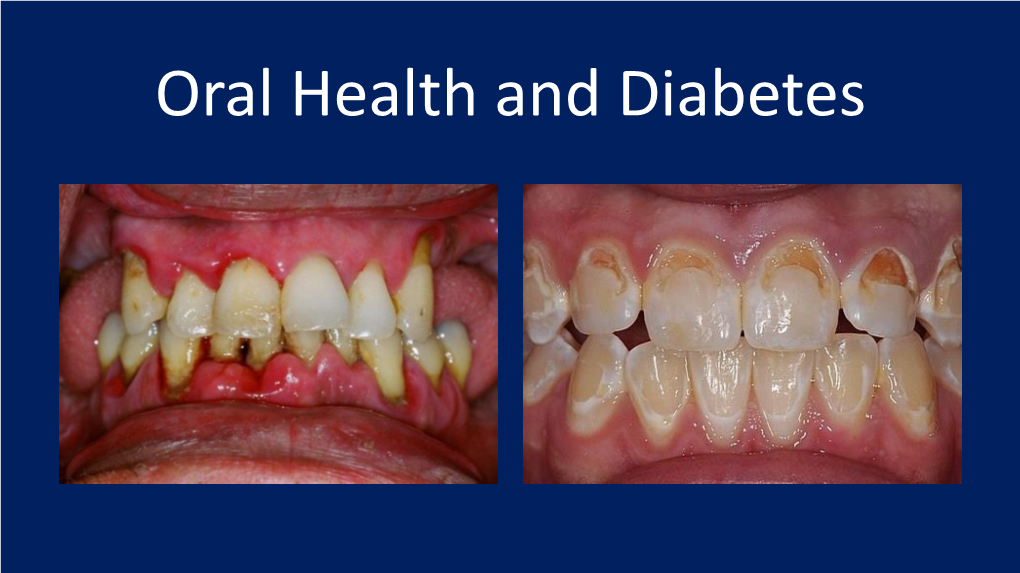 Oral Health and Diabetes Dr Jacqueline Stuart Bdsc