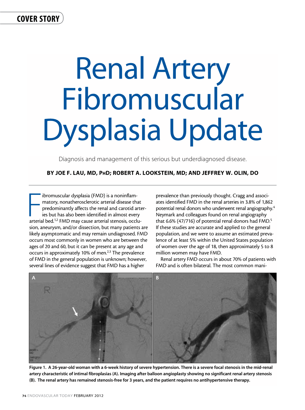 Renal Artery Fibromuscular Dysplasia Update