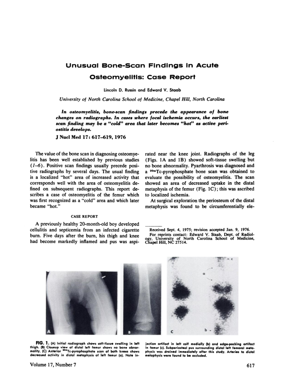 Unusual Boneâ€”Scan Findings in Acute Osteomyelitis: Case Report