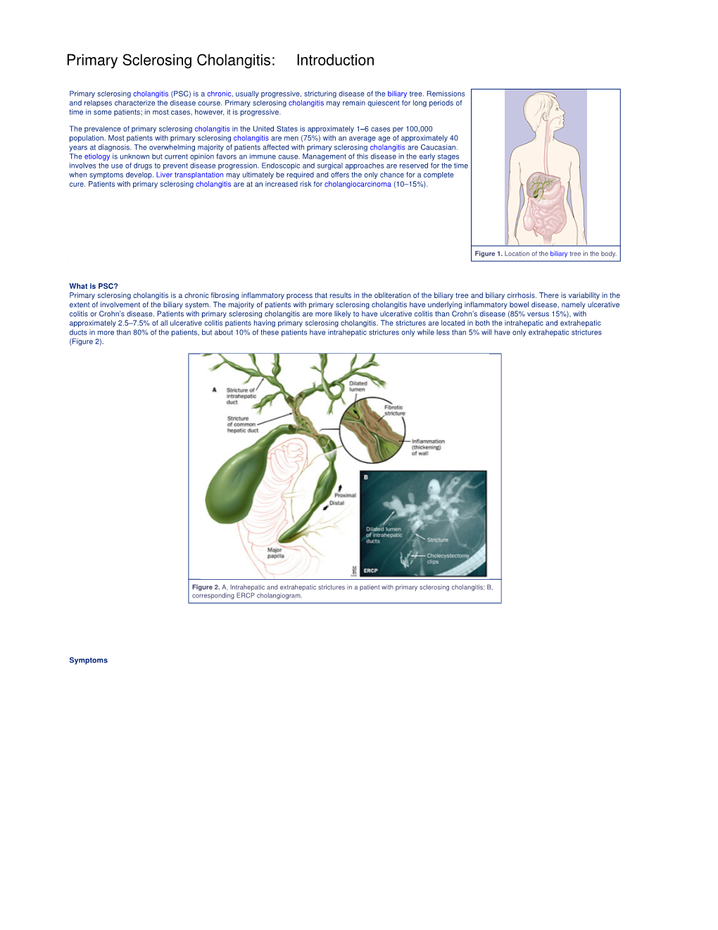 Primary Sclerosing Cholangitis: Introduction