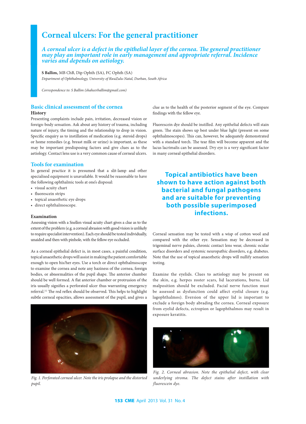 Corneal Ulcers: for the General Practitioner