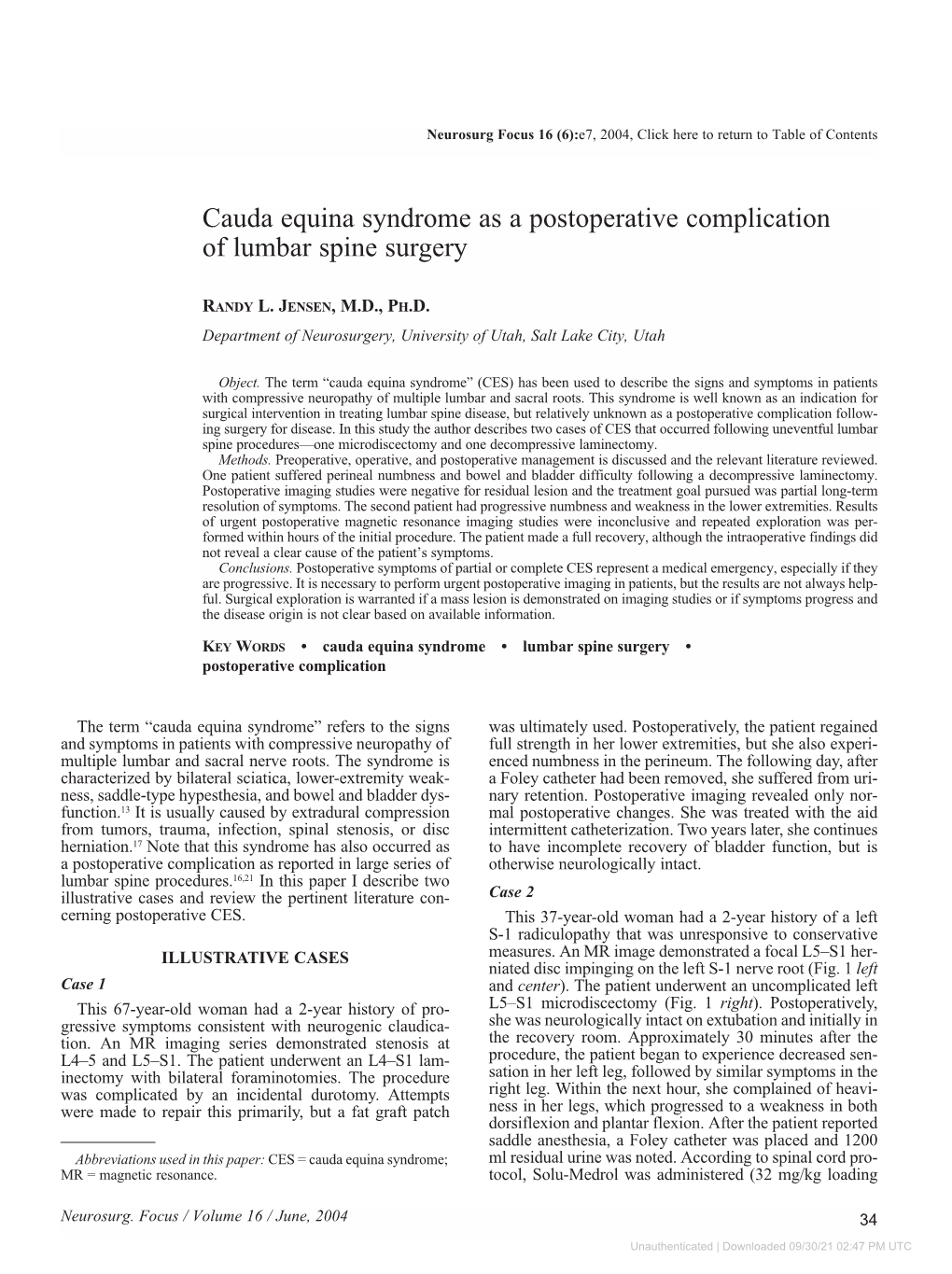 Cauda Equina Syndrome As a Postoperative Complication of Lumbar Spine Surgery