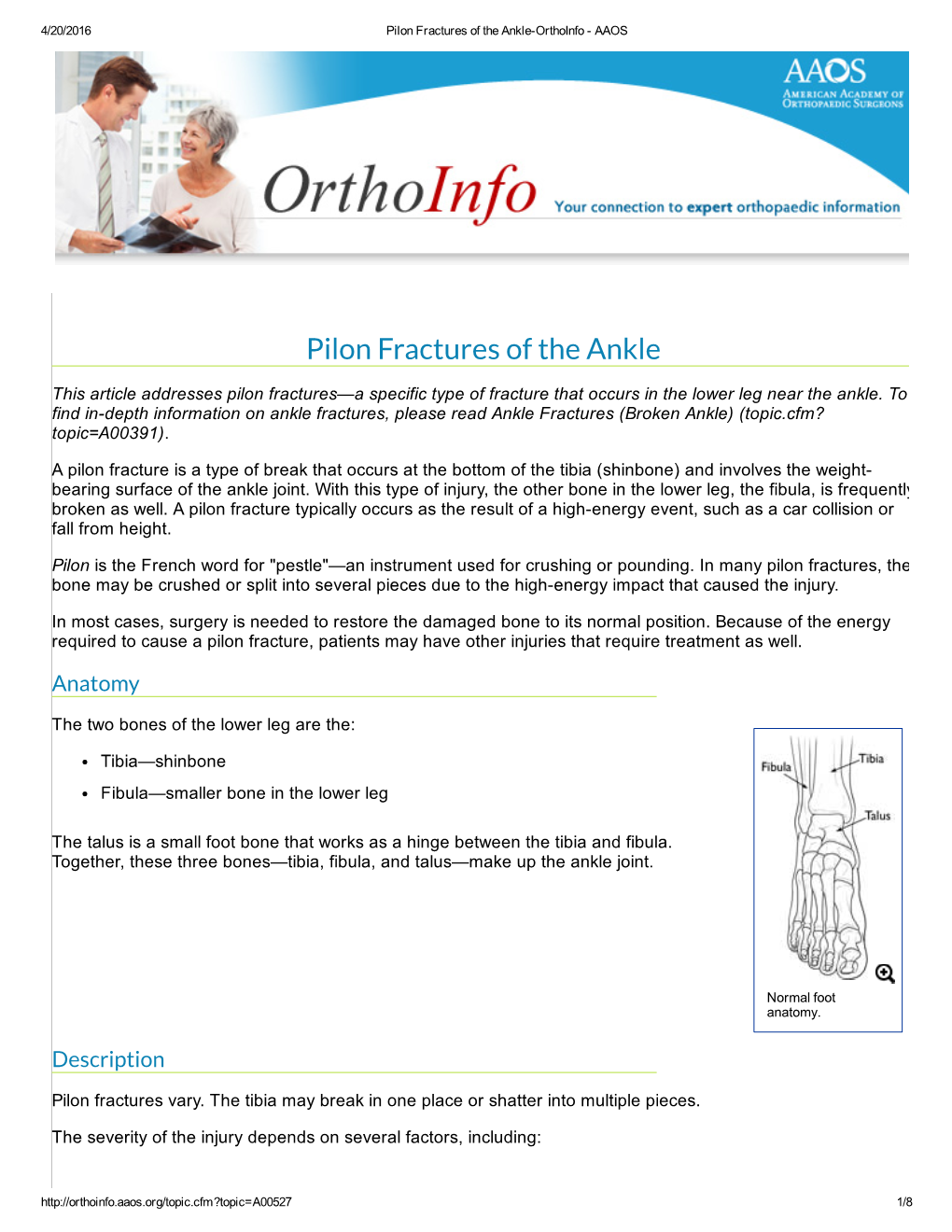 Pilon Fractures of the Ankle­Orthoinfo ­ AAOS