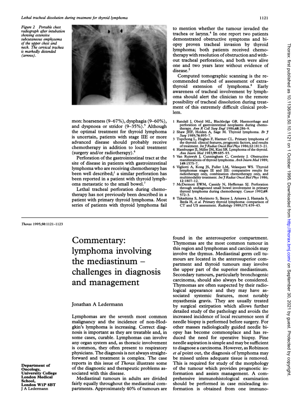 Lymphoma Involving the Mediastinum Challenges in Diagnosis