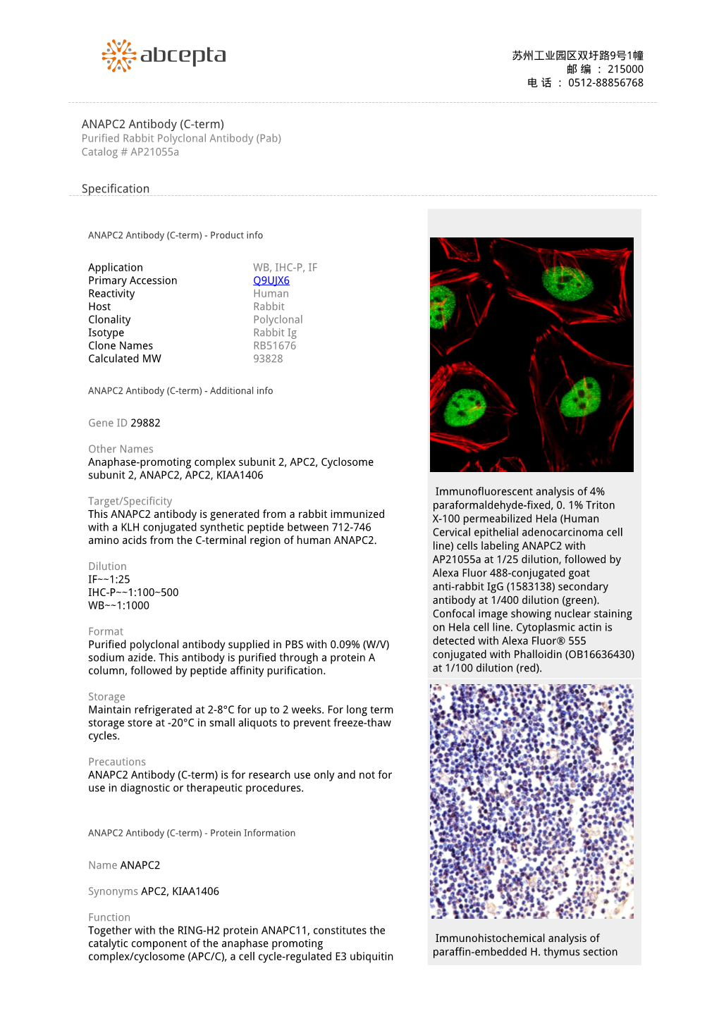 ANAPC2 Antibody (C-Term) Purified Rabbit Polyclonal Antibody (Pab) Catalog # Ap21055a