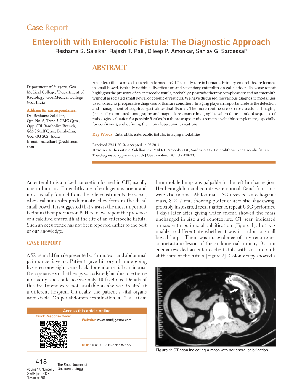 Enterolith with Enterocolic Fistula: the Diagnostic Approach Reshama S