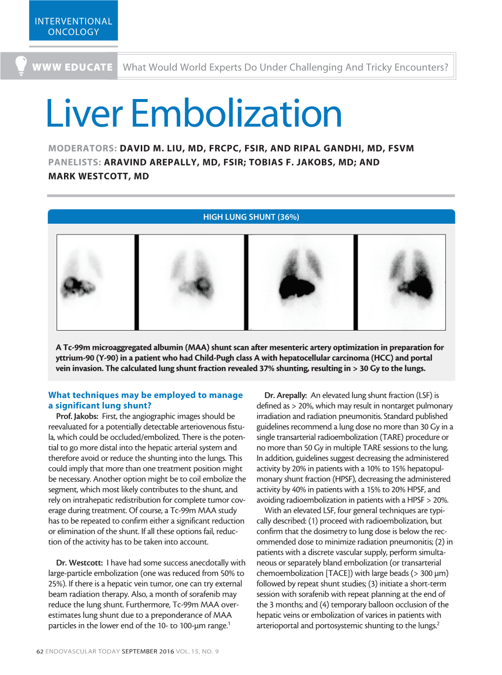 Liver Embolization MODERATORS: DAVID M