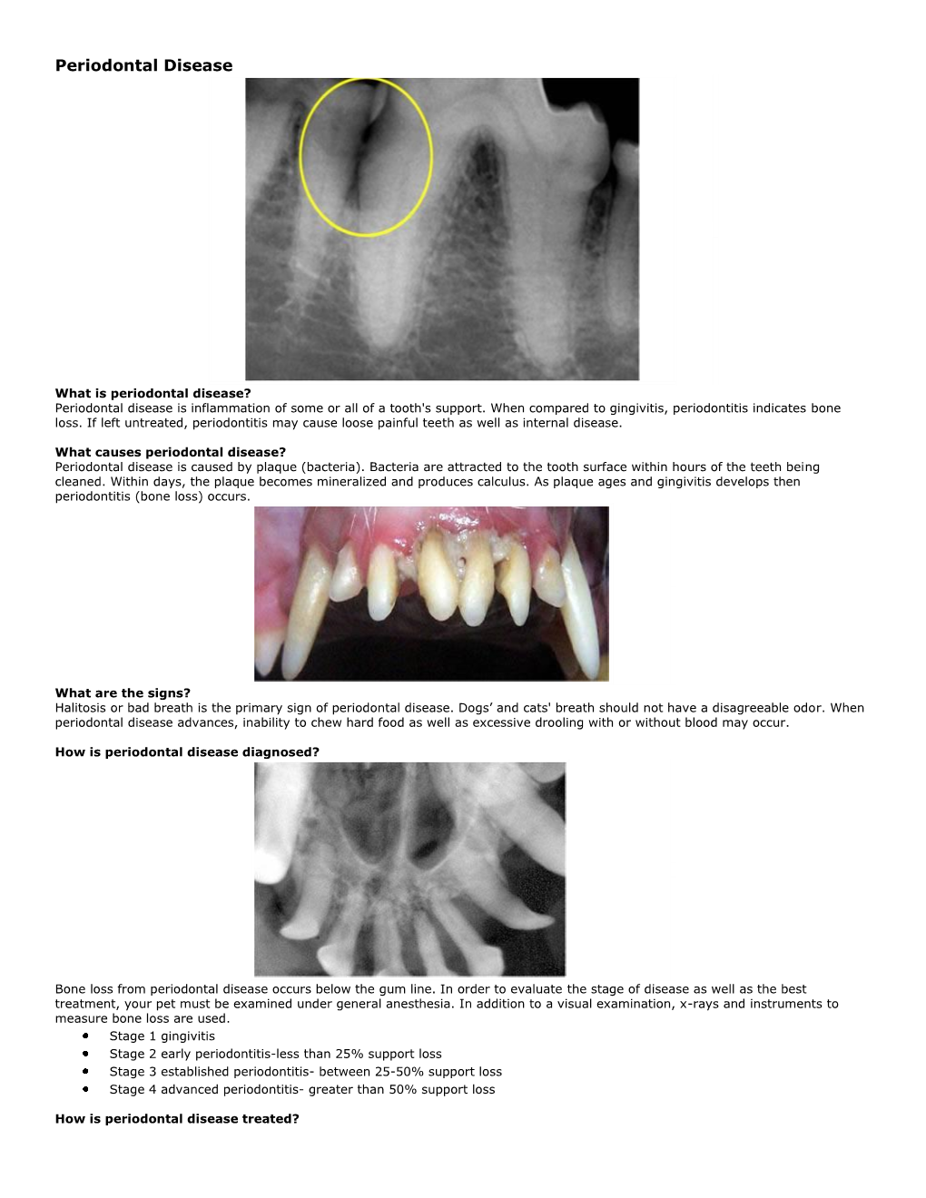 Dental Disease