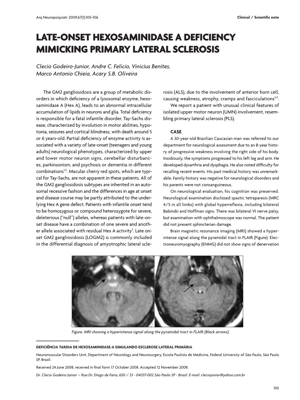 Late-Onset Hexosaminidase a Deficiency Mimicking Primary Lateral Sclerosis