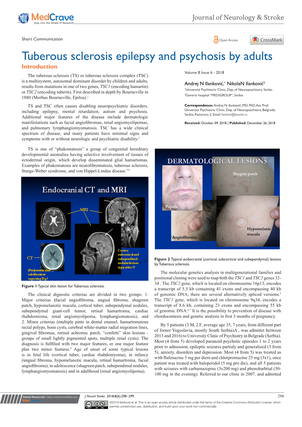 Tuberous Sclerosis Epilepsy and Psychosis by Adults