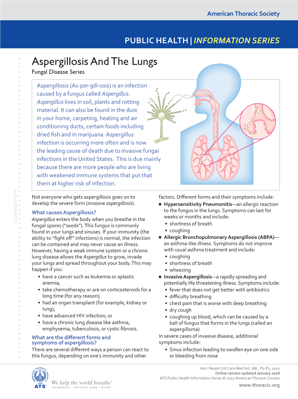 Aspergillosis and the Lungs Fungal Disease Series