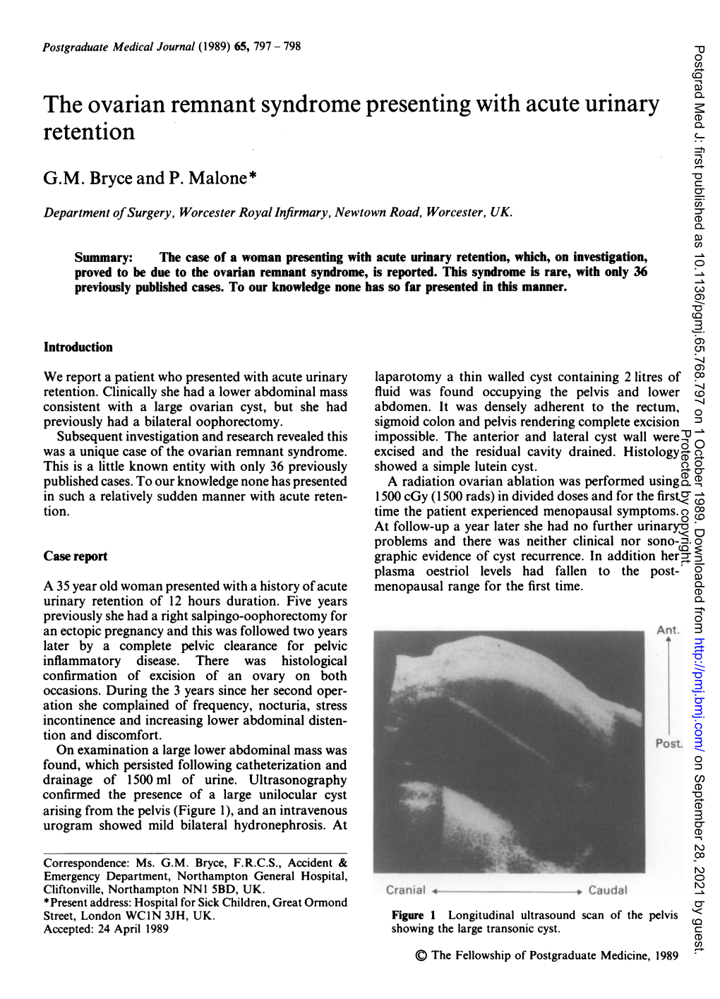 The Ovarian Remnant Syndrome Presentingwith Acute Urinary Retention