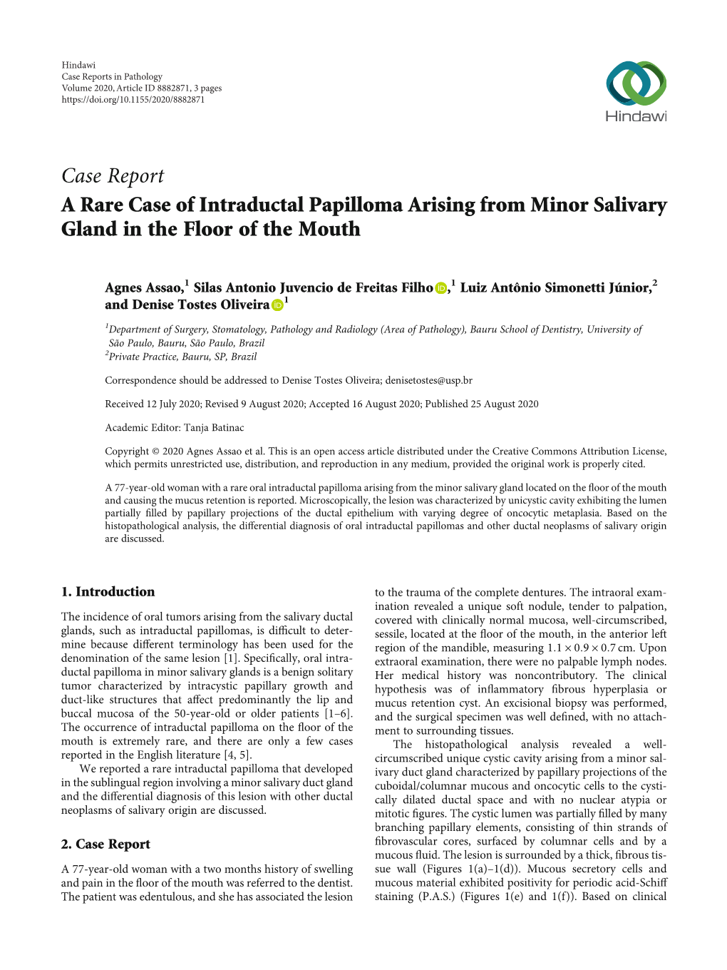 A Rare Case of Intraductal Papilloma Arising from Minor Salivary Gland in the Floor of the Mouth