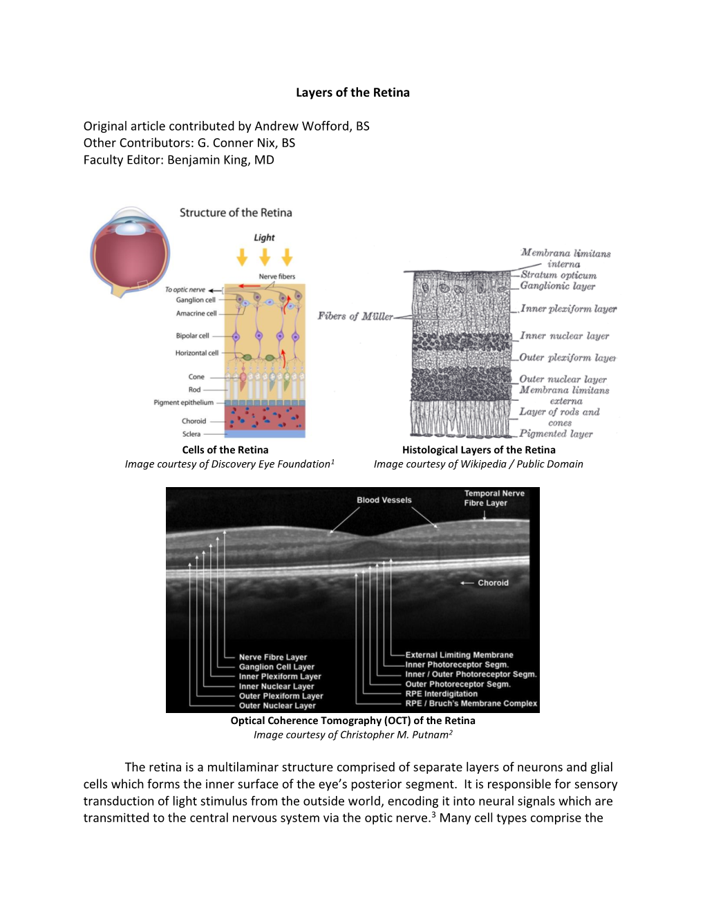 Layers of the Retina Original Article Contributed by Andrew Wofford, BS