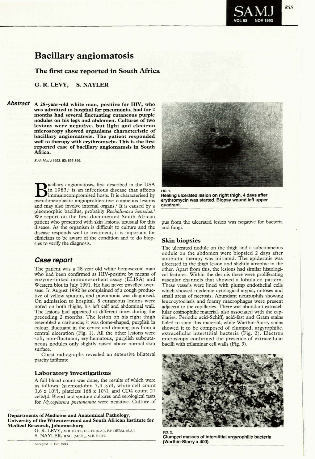 Bacillary Angiomatosis