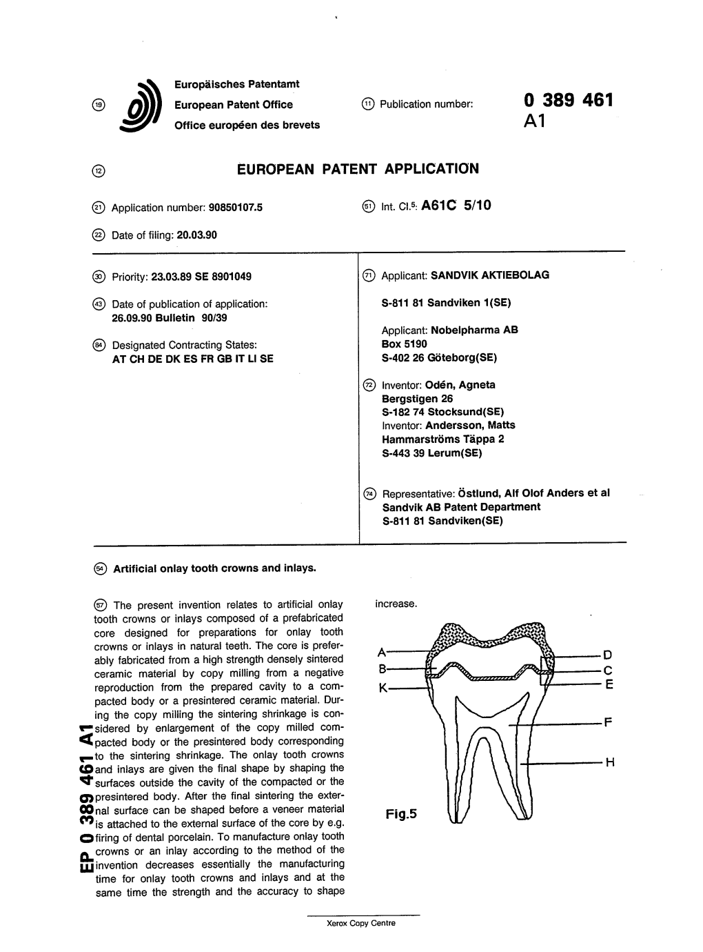 Artificial Onlay Tooth Crowns and Inlays