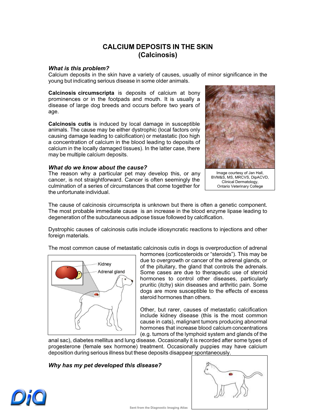 CALCIUM DEPOSITS in the SKIN (Calcinosis)