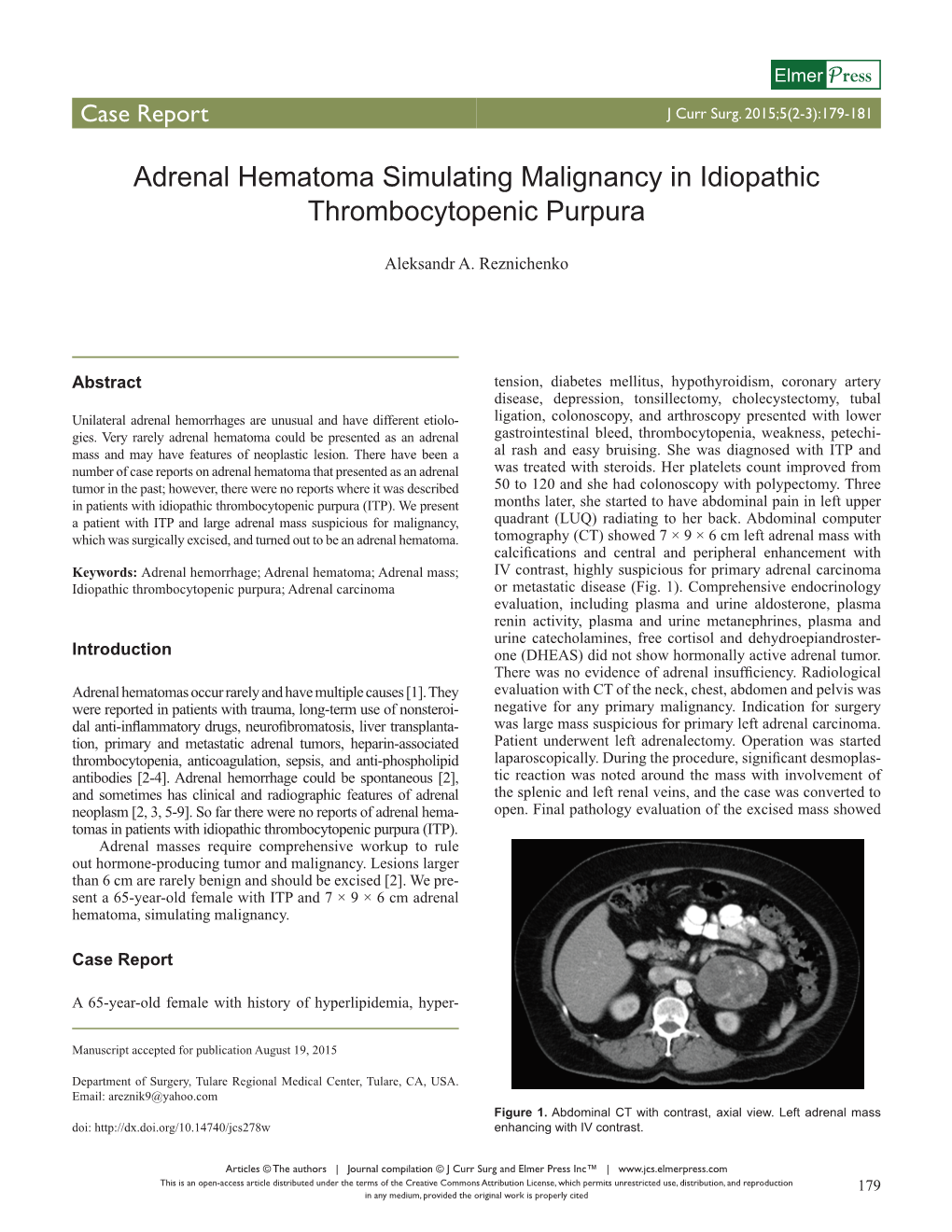 Adrenal Hematoma Simulating Malignancy in Idiopathic Thrombocytopenic Purpura