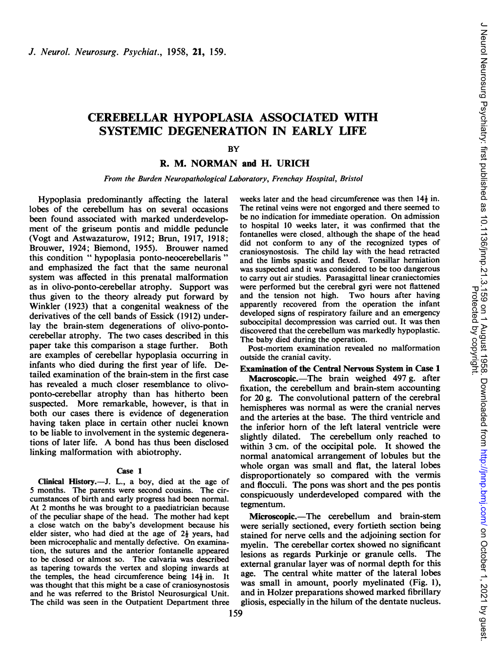 Cerebellar Hypoplasia Associated with Systemic Degeneration in Early Life by R