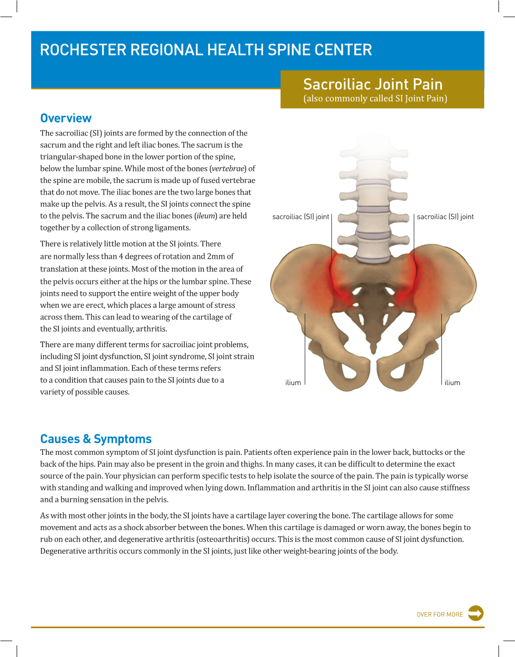 ROCHESTER REGIONAL HEALTH SPINE CENTER Sacroiliac Joint Pain