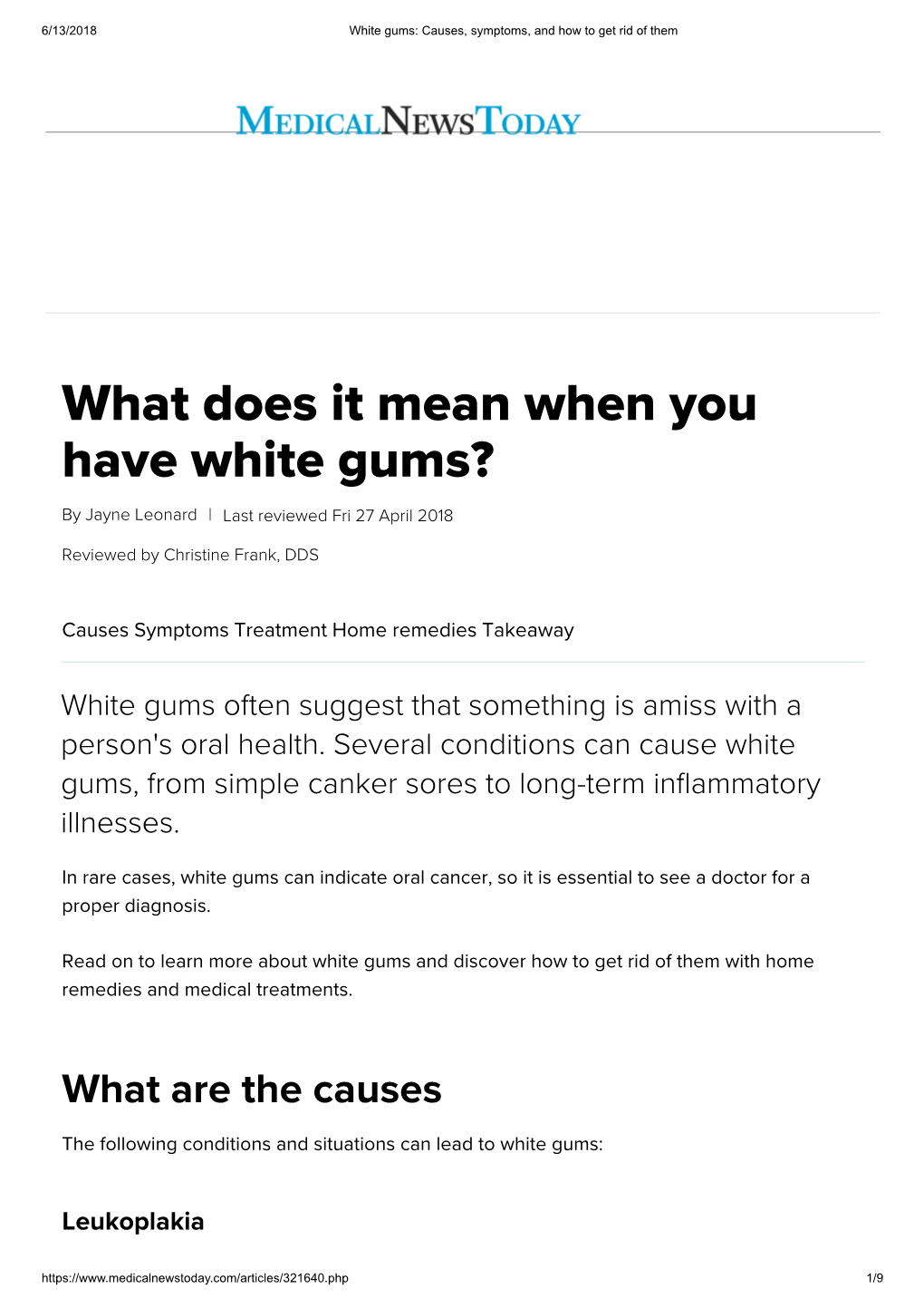 What Does It Mean When You Have White Gums?