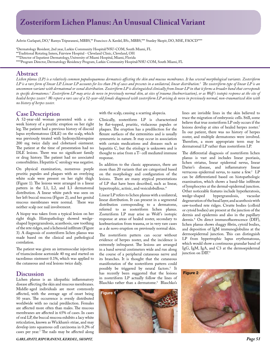 Zosteriform Lichen Planus: an Unusual Clinical Variant