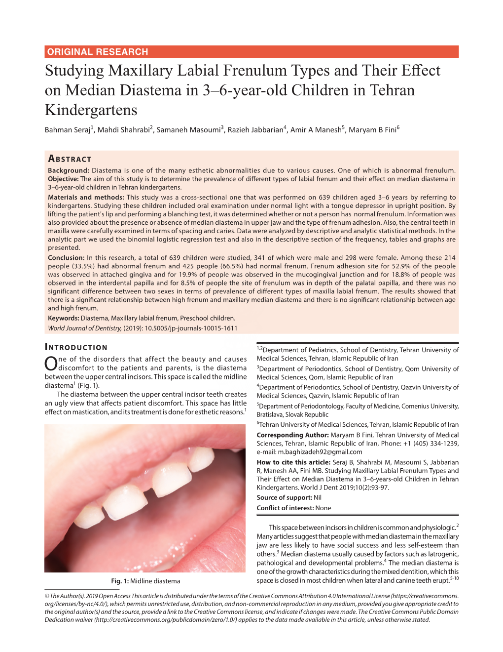Studying Maxillary Labial Frenulum Types and Their Effect on Median Diastema in 3–6-Year-Old Children in Tehran Kindergartens