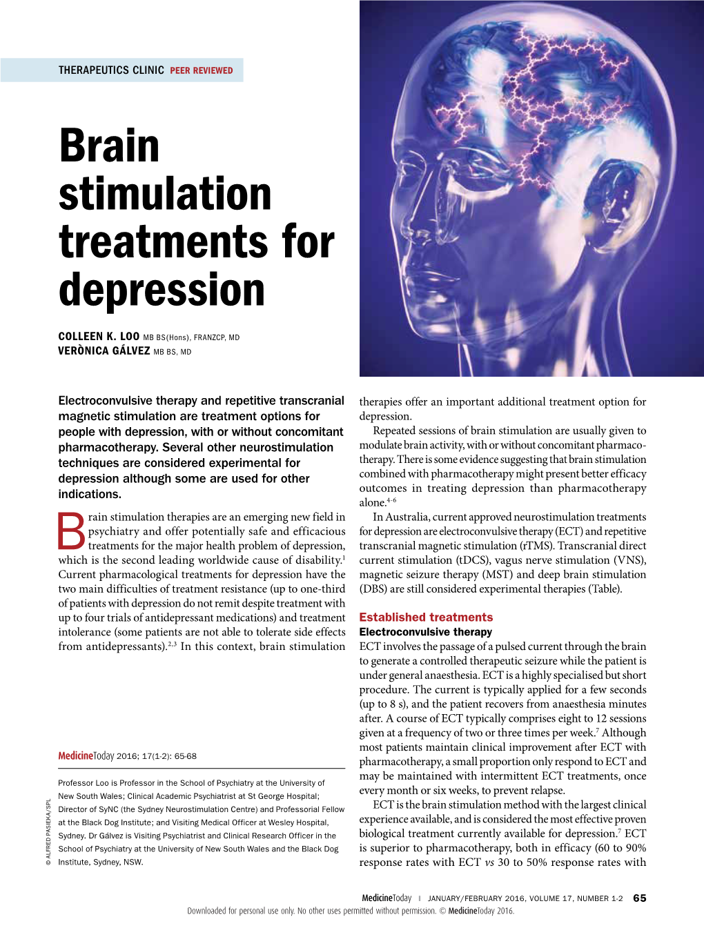 Brain Stimulation Treatments for Depression