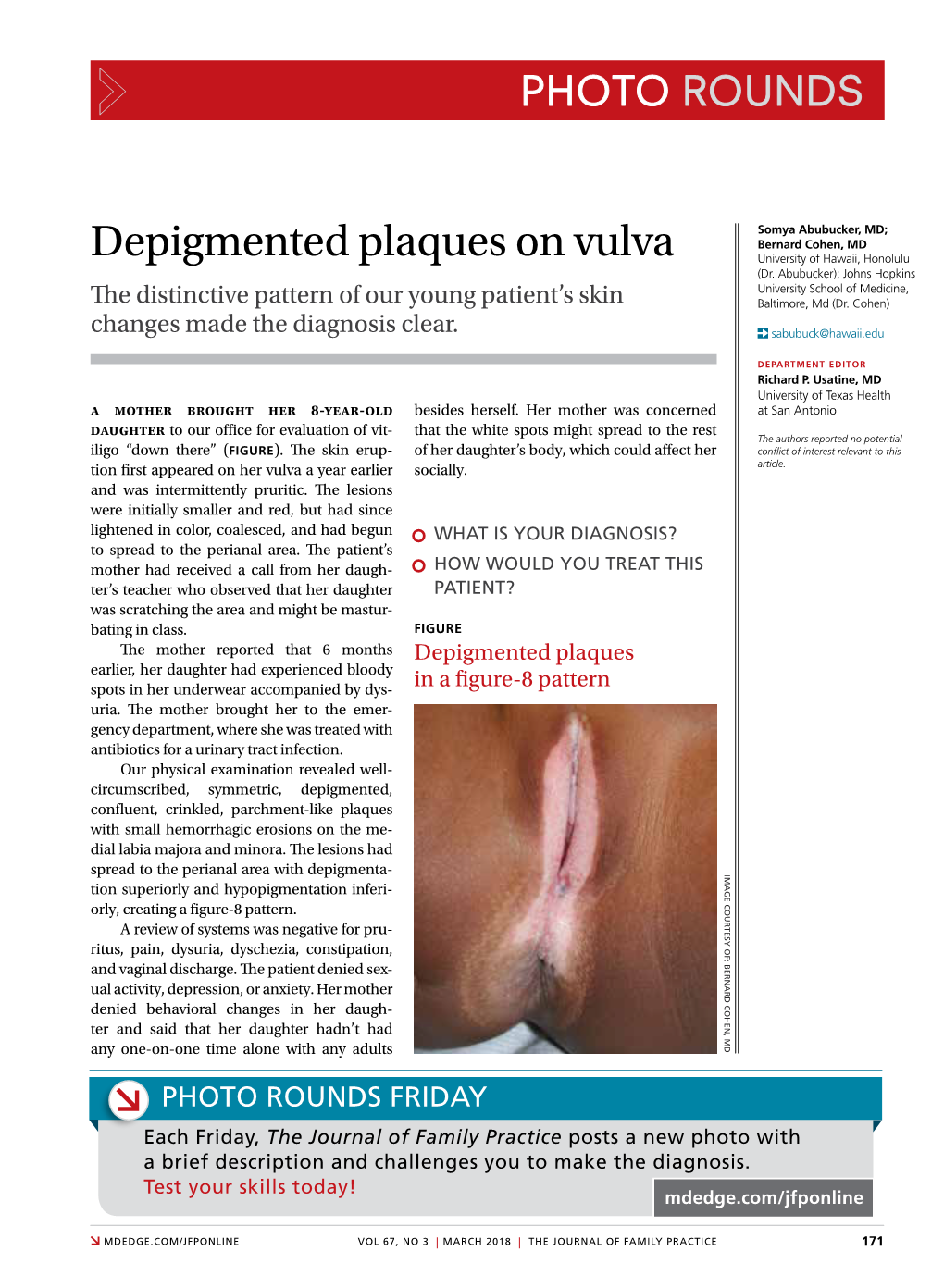 Depigmented Plaques on Vulva University of Hawaii, Honolulu (Dr