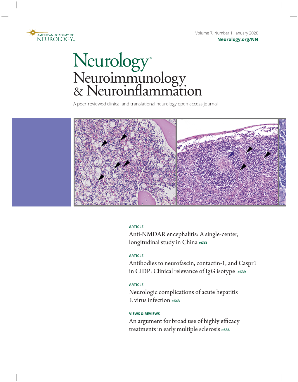 Anti-NMDAR Encephalitis: a Single-Center, Longitudinal Study in China E633