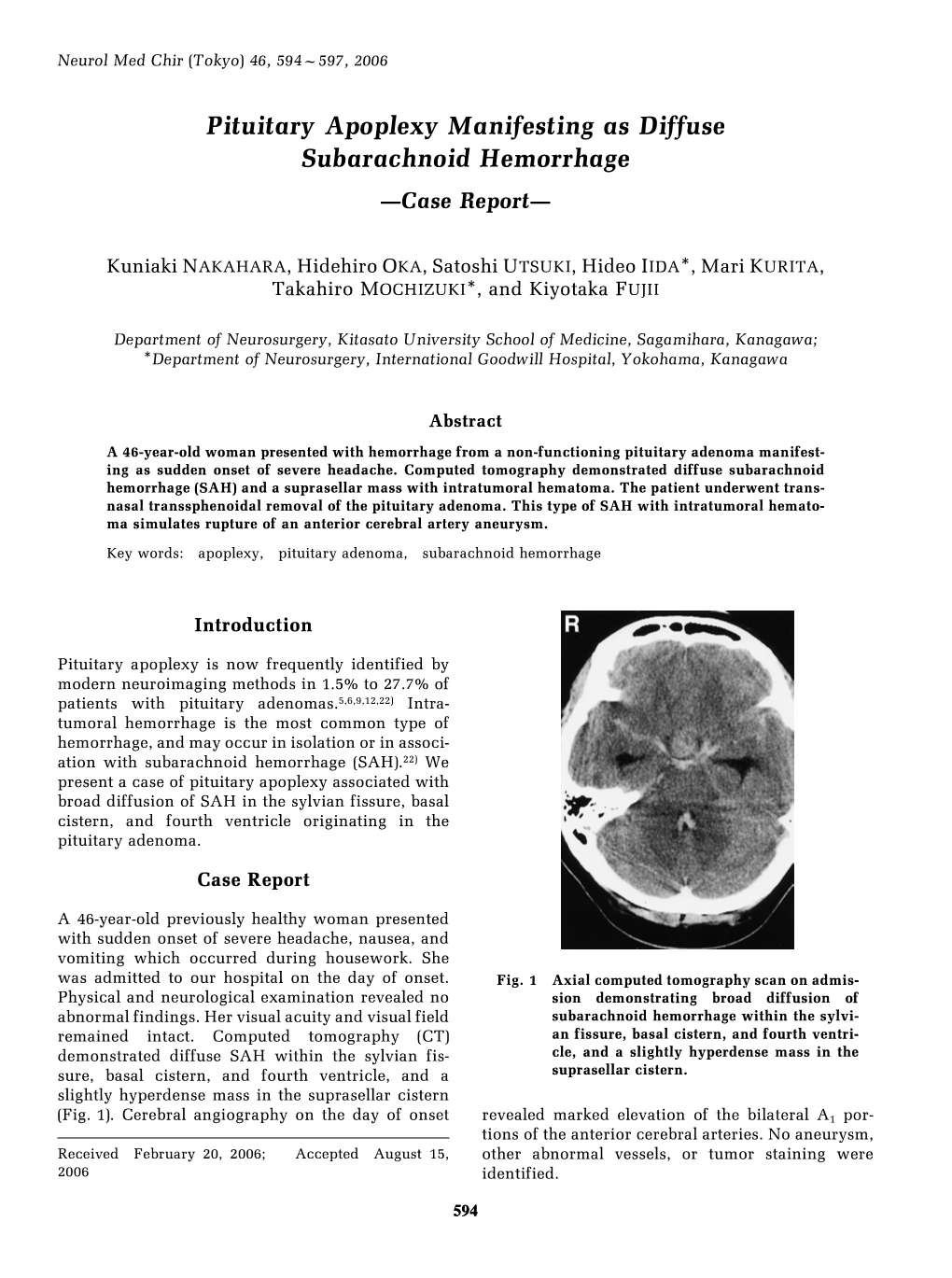 Pituitary Apoplexy Manifesting As Diffuse Subarachnoid Hemorrhage —Case Report—