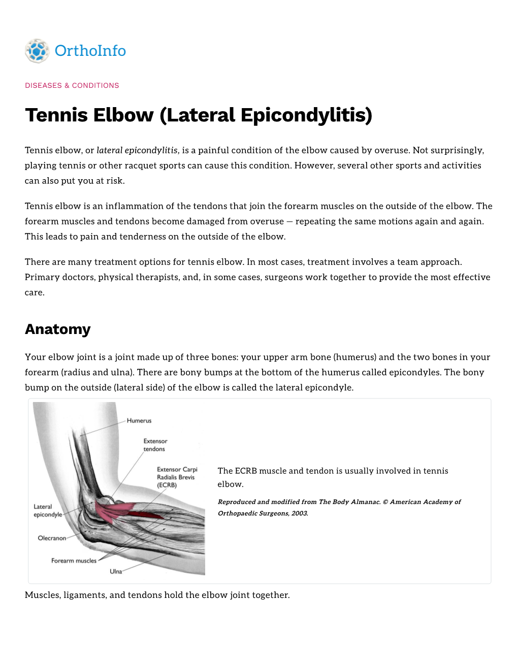 Tennis Elbow (Lateral Epicondylitis)