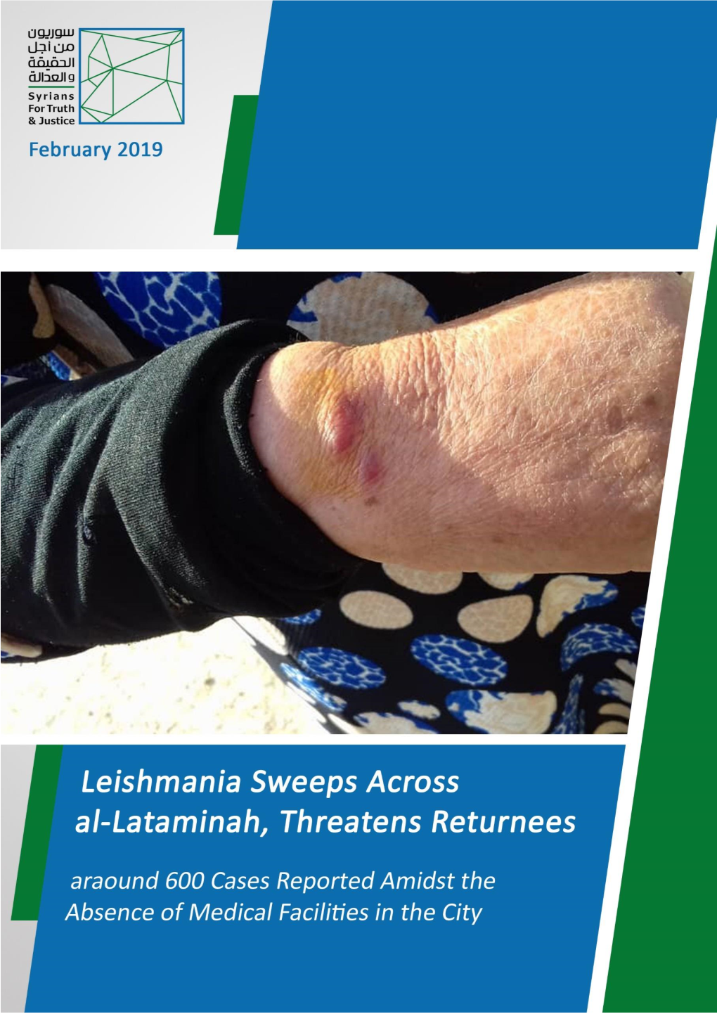Leishmania Sweeps Across Al-Lataminah, Threatens Returnees