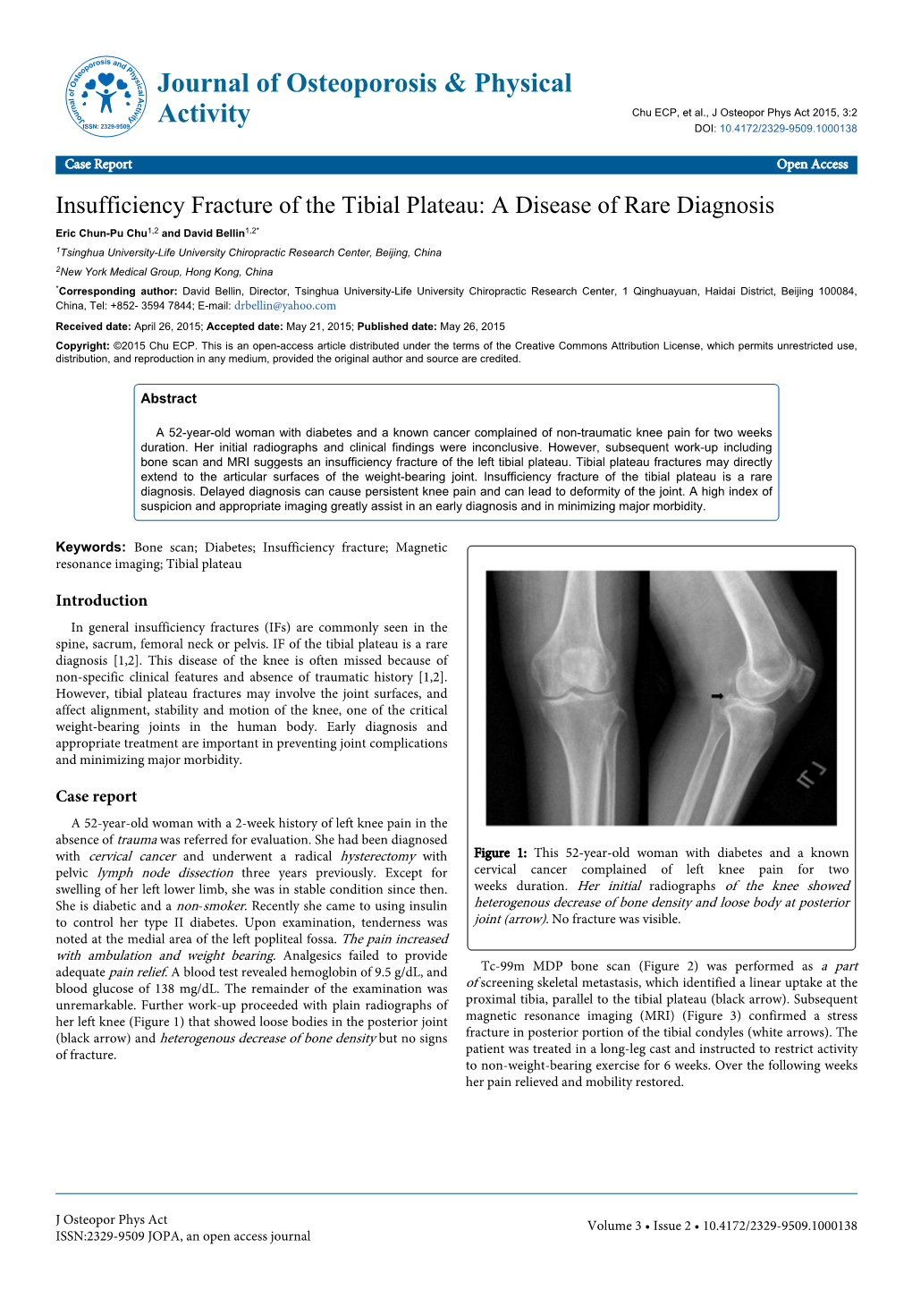 Insufficiency Fracture of the Tibial Plateau: a Disease of Rare Diagnosis