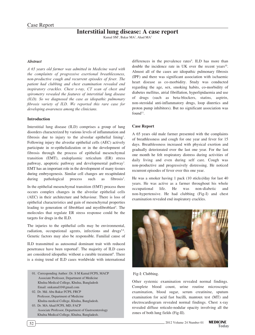 Interstitial Lung Disease: a Case Report Anti-Thymocyte Globulin, Intravenous Immunoglobulin and 1 2 3 Study