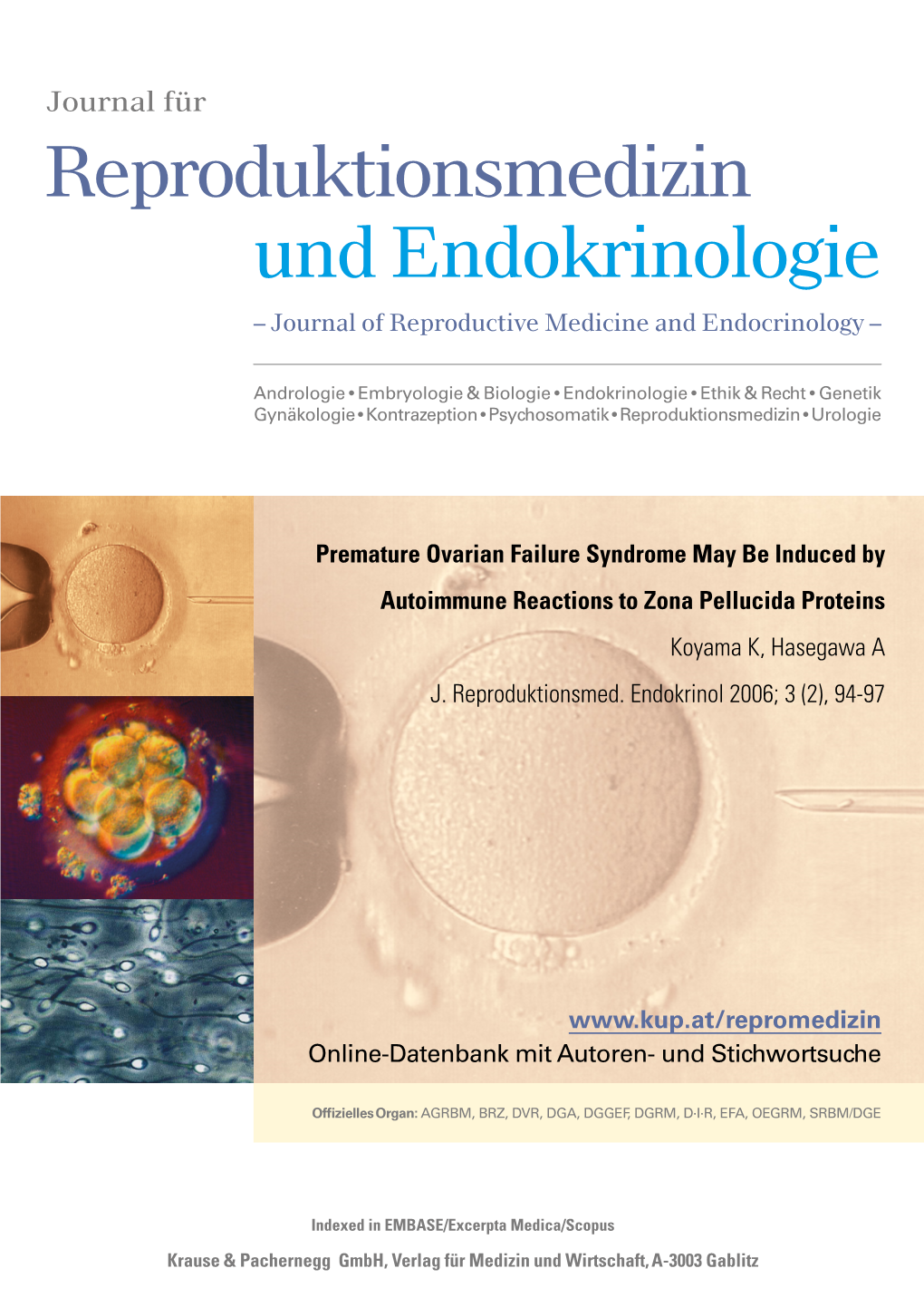 Premature Ovarian Failure Syndrome May Be Induced by Autoimmune Reactions to Zona Pellucida Proteins Koyama K, Hasegawa a J